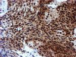 RUVBL2 Antibody in Immunohistochemistry (Paraffin) (IHC (P))