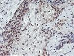 GADD34 Antibody in Immunohistochemistry (Paraffin) (IHC (P))