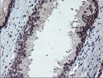 GADD34 Antibody in Immunohistochemistry (Paraffin) (IHC (P))