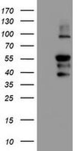 GADD34 Antibody in Western Blot (WB)