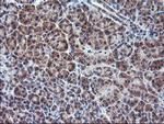 GADD34 Antibody in Immunohistochemistry (Paraffin) (IHC (P))