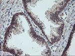 GADD34 Antibody in Immunohistochemistry (Paraffin) (IHC (P))