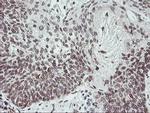 C20orf3 Antibody in Immunohistochemistry (Paraffin) (IHC (P))