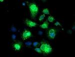 Neuroplastin Antibody in Immunocytochemistry (ICC/IF)