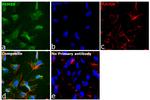 PSMB9 Antibody in Immunocytochemistry (ICC/IF)