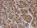 PSMB9 Antibody in Immunohistochemistry (Paraffin) (IHC (P))