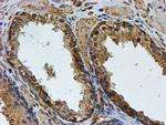 PSMB9 Antibody in Immunohistochemistry (Paraffin) (IHC (P))