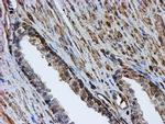 PSMB9 Antibody in Immunohistochemistry (Paraffin) (IHC (P))