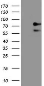 ALOX15 Antibody in Western Blot (WB)