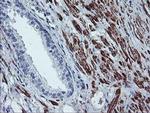 BCAT1 Antibody in Immunohistochemistry (Paraffin) (IHC (P))