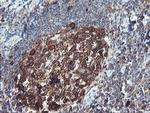 BCAT1 Antibody in Immunohistochemistry (Paraffin) (IHC (P))