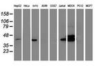 BCAT1 Antibody in Western Blot (WB)