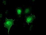 SH2D2A Antibody in Immunocytochemistry (ICC/IF)