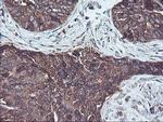 SH2D2A Antibody in Immunohistochemistry (Paraffin) (IHC (P))