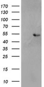 SH2D2A Antibody in Western Blot (WB)