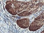 PSMB7 Antibody in Immunohistochemistry (Paraffin) (IHC (P))