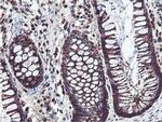 PSMB7 Antibody in Immunohistochemistry (Paraffin) (IHC (P))