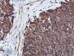 PSMB7 Antibody in Immunohistochemistry (Paraffin) (IHC (P))