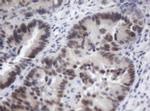 ACD Antibody in Immunohistochemistry (Paraffin) (IHC (P))