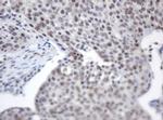 ACD Antibody in Immunohistochemistry (Paraffin) (IHC (P))