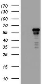 ACD Antibody in Western Blot (WB)