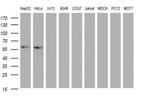 ACD Antibody in Western Blot (WB)