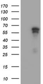 ACD Antibody in Western Blot (WB)