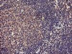 TMEFF2 Antibody in Immunohistochemistry (Paraffin) (IHC (P))