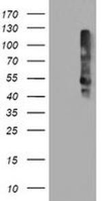 TMEFF2 Antibody in Western Blot (WB)