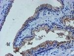 LIM1 Antibody in Immunohistochemistry (Paraffin) (IHC (P))