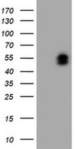 LIM1 Antibody in Western Blot (WB)