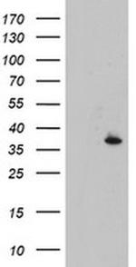 CYB5R1 Antibody in Western Blot (WB)