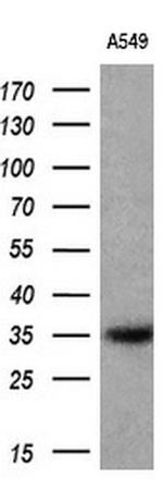 CYB5R1 Antibody in Western Blot (WB)