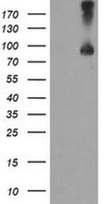 TFR2 Antibody in Western Blot (WB)