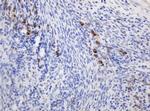 Ribophorin II Antibody in Immunohistochemistry (Paraffin) (IHC (P))