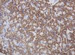 Ribophorin II Antibody in Immunohistochemistry (Paraffin) (IHC (P))