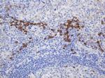 Ribophorin II Antibody in Immunohistochemistry (Paraffin) (IHC (P))