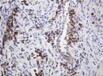 Ribophorin II Antibody in Immunohistochemistry (Paraffin) (IHC (P))