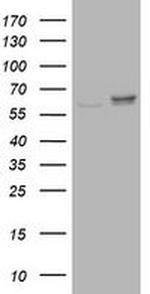 Ribophorin II Antibody in Western Blot (WB)