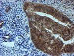 SAT2 Antibody in Immunohistochemistry (Paraffin) (IHC (P))