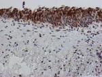 SAT2 Antibody in Immunohistochemistry (Paraffin) (IHC (P))