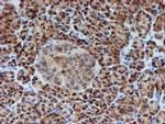 SAT2 Antibody in Immunohistochemistry (Paraffin) (IHC (P))