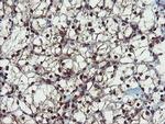 PPAT Antibody in Immunohistochemistry (Paraffin) (IHC (P))