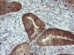 PPAT Antibody in Immunohistochemistry (Paraffin) (IHC (P))