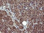 PPAT Antibody in Immunohistochemistry (Paraffin) (IHC (P))