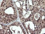 PPAT Antibody in Immunohistochemistry (Paraffin) (IHC (P))