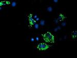 ACSF2 Antibody in Immunocytochemistry (ICC/IF)