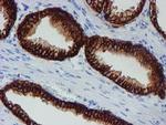 SRPRB Antibody in Immunohistochemistry (Paraffin) (IHC (P))