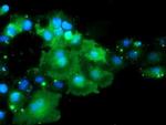 DOK7 Antibody in Immunocytochemistry (ICC/IF)