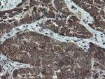 DOK7 Antibody in Immunohistochemistry (Paraffin) (IHC (P))